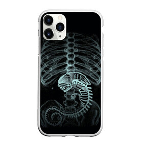 Чехол для iPhone 11 Pro матовый с принтом Чужой на Рентгене в Белгороде, Силикон |  | alien | больница | больной | внутренний мир | врач | клиника | кости | пациент | ребра | рентген | скелет | снимок | хищник