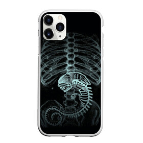 Чехол для iPhone 11 Pro Max матовый с принтом Чужой на Рентгене в Белгороде, Силикон |  | alien | больница | больной | внутренний мир | врач | клиника | кости | пациент | ребра | рентген | скелет | снимок | хищник