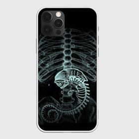 Чехол для iPhone 12 Pro Max с принтом Чужой на Рентгене в Белгороде, Силикон |  | alien | больница | больной | внутренний мир | врач | клиника | кости | пациент | ребра | рентген | скелет | снимок | хищник