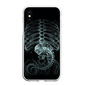 Чехол для iPhone XS Max матовый с принтом Чужой на Рентгене в Белгороде, Силикон | Область печати: задняя сторона чехла, без боковых панелей | Тематика изображения на принте: alien | больница | больной | внутренний мир | врач | клиника | кости | пациент | ребра | рентген | скелет | снимок | хищник